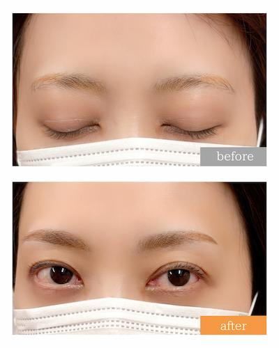 アートメイク症例