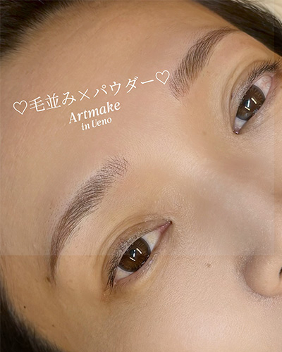 アートメイク症例