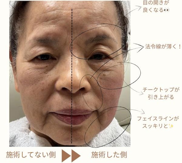 美容皮膚科｜上野皮フ科・婦人科クリニック｜新御徒町駅の皮膚科・美容