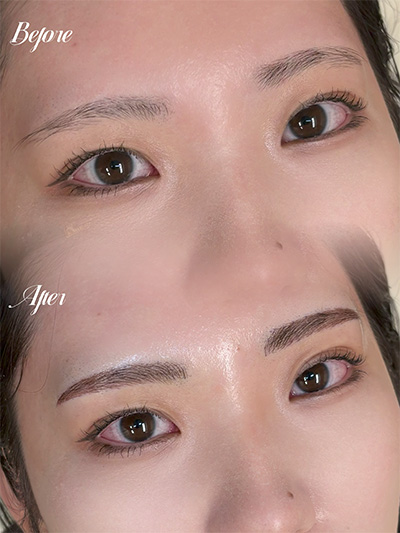 アートメイク症例