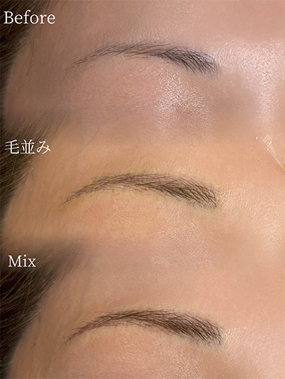 アートメイク症例