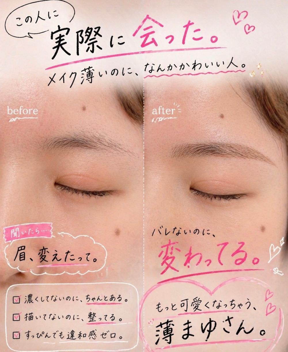 アートメイク症例