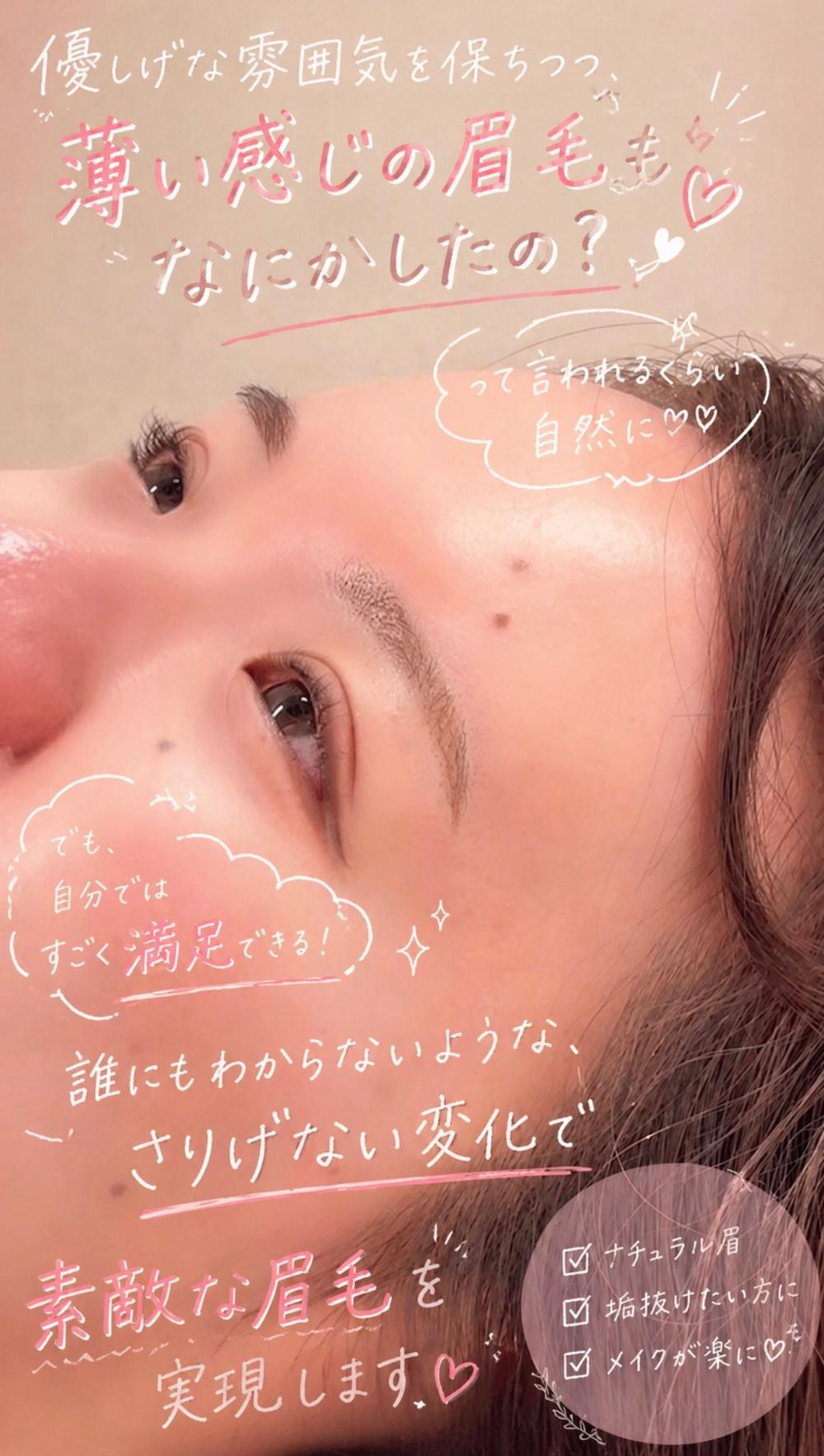 アートメイク症例
