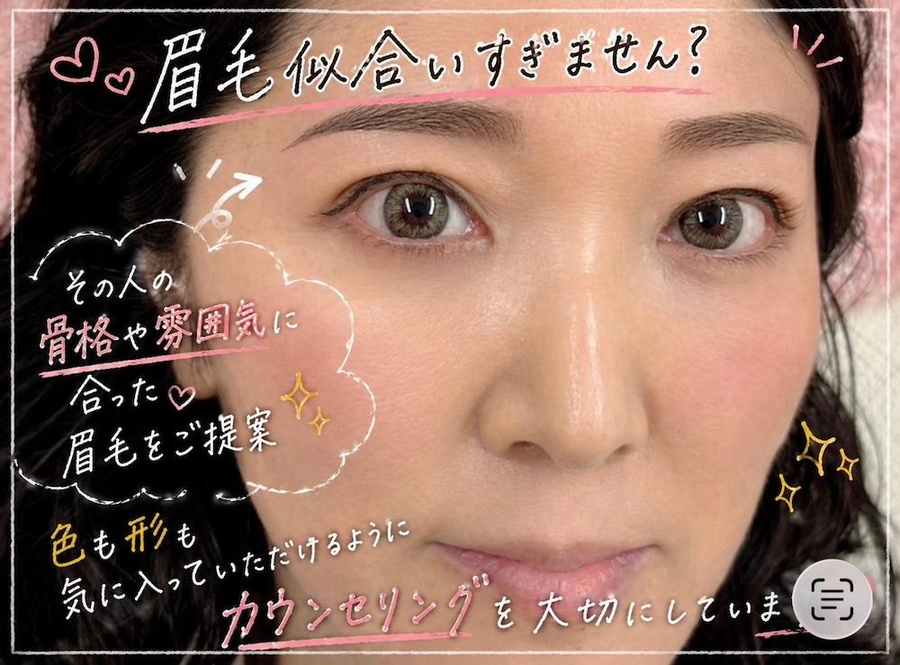 アートメイク症例