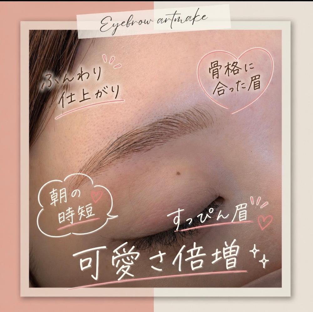 アートメイク症例