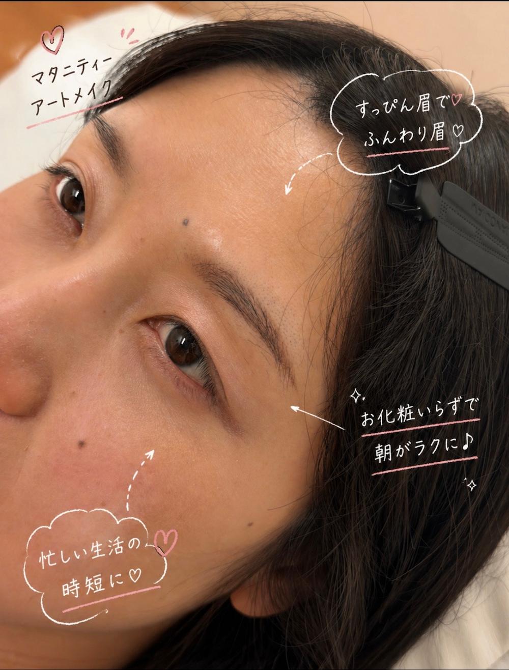 アートメイク症例