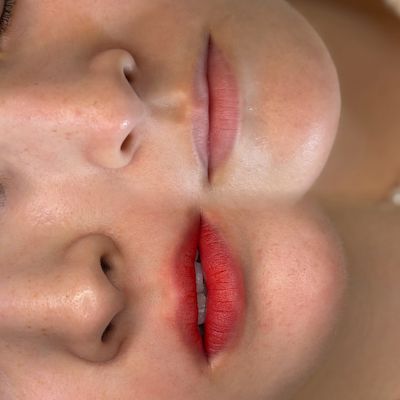 アートメイク症例